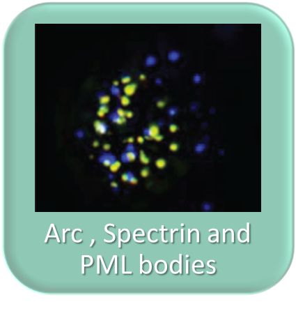 Arc is a nuclear protein that associates with PML bodies