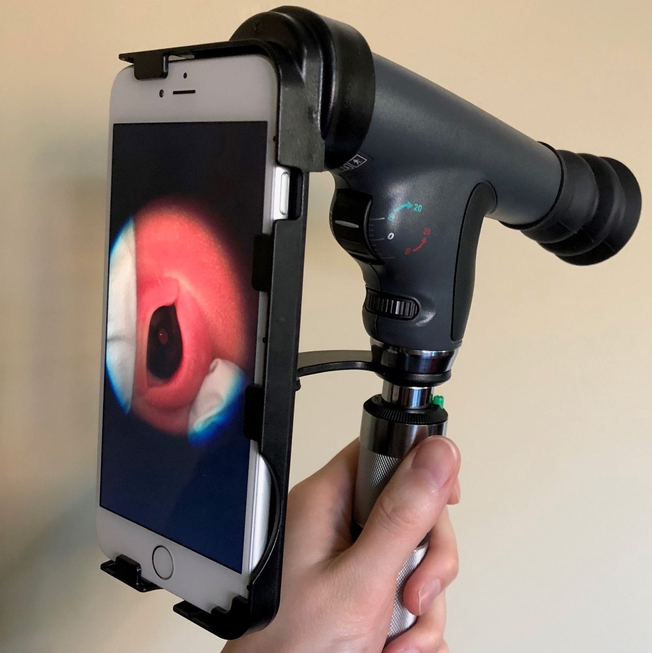  Farsiu deep learning handheld cell phone camera pediatric Open-source, machine and deep learning-based automated algorithm for gestational age estimation through smartphone lens imaging